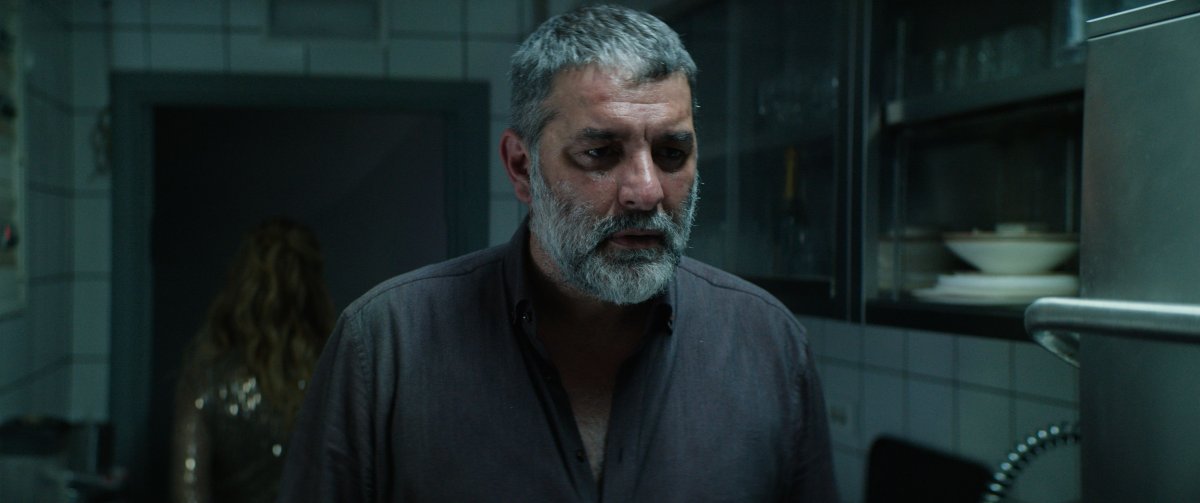 ΣΠΑΣΜΕΝΗ ΦΛΕΒΑ